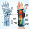 Elastic Wrist Splint